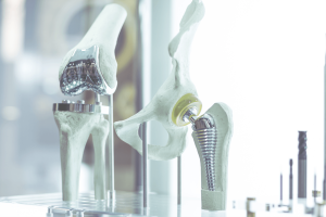 recuperación tras prótesis de rodilla