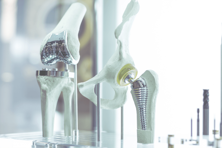 recuperación tras prótesis de rodilla